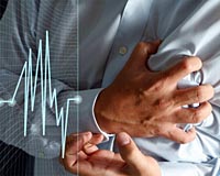 Осложнения при ишемической болезни сердца. Инфаркт миокарда Осложнения при ишемической болезни сердца. Инфаркт миокарда